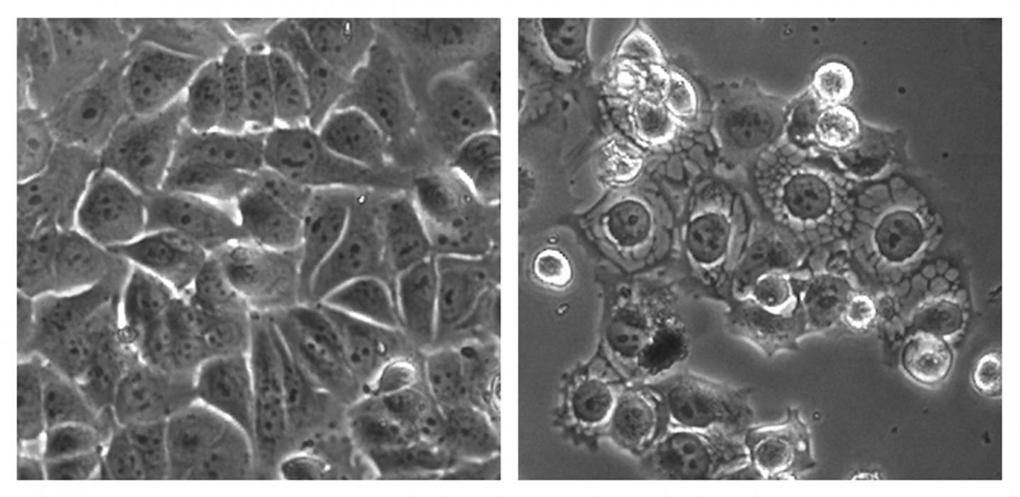 Cancer cells were treated with a control (left) and the overstimulating compound MCB-613 (right). (Credit: Lei Wang)