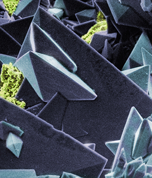 Pictured is the surface of a kidney stone with calcium oxalate crystals. (Source: WUSTL/Wikimedia, E.K. KEMPF)