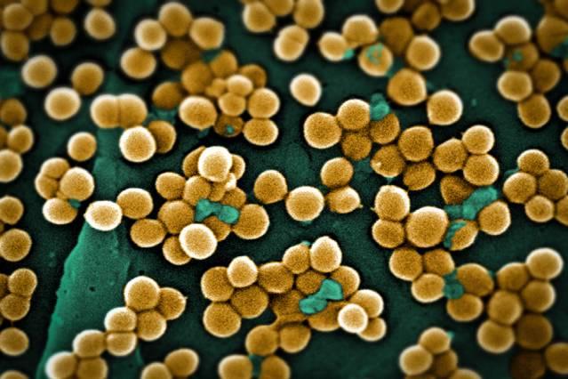 A scanning electron micrograph depicts numerous clumps of methicillin-resistant Staphylococcus aureus bacteria, commonly referred to by the acronym MRSA. (Source: MIT/Janice Haney Carr, CDC)