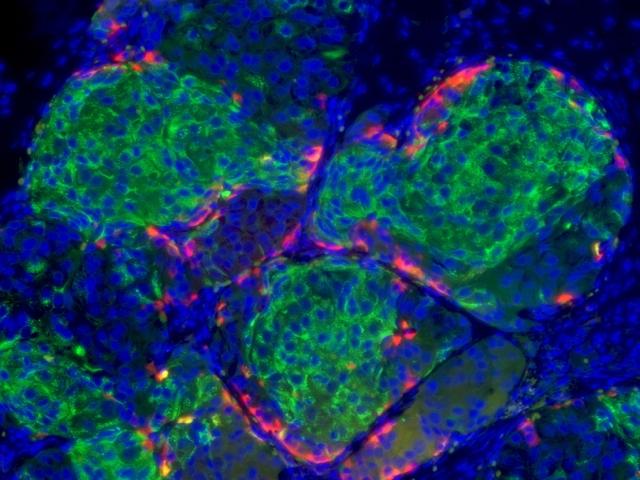 Growing beta cells. (Source: Harvard Stem Cell Institute)