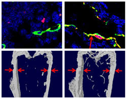 Osteoporosis caused by induced menopause improves in mice treated with the drug L-235 as shown by (TOP) an increase in specialized blood vessels (yellow) required for bone building and (BOTTOM) increased bone density in the pelvis and leg bones. Untreated, left; treated, right. (Source: Xu Cao)