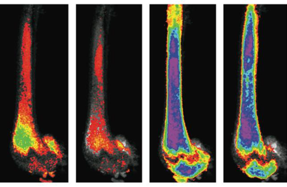 Images of bones stained with osmium. Left: bone fat decreased due to exercise. Right: bones of mice on high dose of rosiglitazone. Far right image shows decrease in bone fat due to exercise. (Source: UNC Health Care)