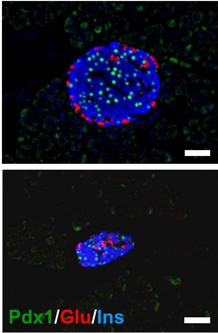 In normal mice (top), the pancreas forms with normal spatial organization as seen by the distinct patterning of different colored cell types. In Pdx1 mutant mice (bottom), however, the pancreas is much smaller and loses its spatial organization. Scale bars = 50 micro meter. Source: Kawaguchi Laboratory, CiRA, Kyoto University