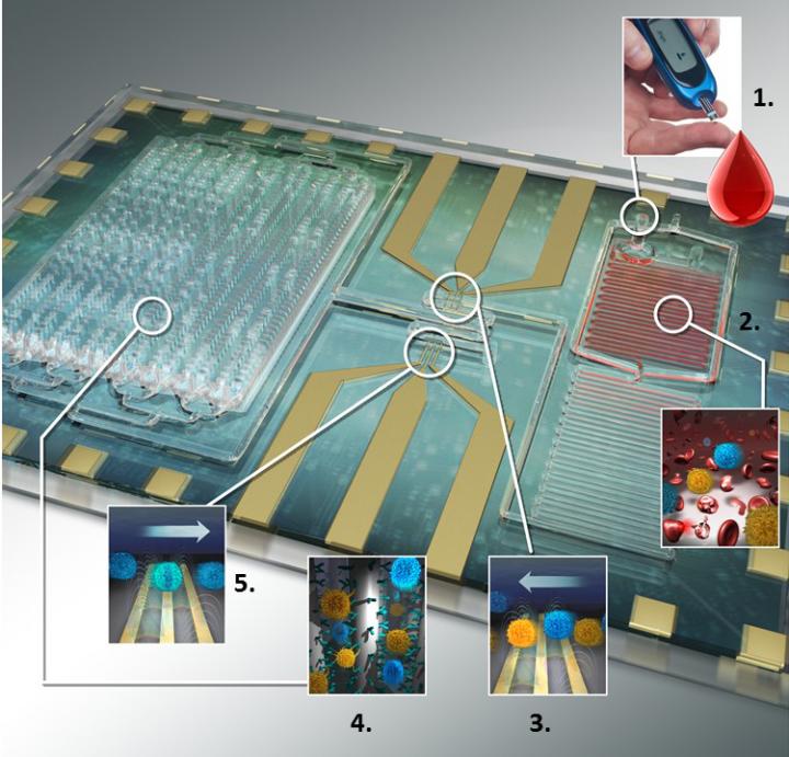 Differential immuno-capture biochip schematic: 1. Ten microliters of blood is infused into the biochip. 2. Erythrocytes were lysed and the leukocytes were preserved using as custom-made lysing and quenching buffers get mixed with blood. 3. The leukocytes pass over co-planar platinum microfabricated electrodes and are counted. 4. Specific cell antibodies e.g. monoclonal CD4 T cell antibody is initially adsorbed on the capture chamber. CD4 T cells get captured as they interact with the antibodies in the chamber. 5. Remaining leukocytes gets counted again with second counter. The difference in the respective cell counts give the concentration of the cells captured. Credit: Umer Hassan, University of Illinois