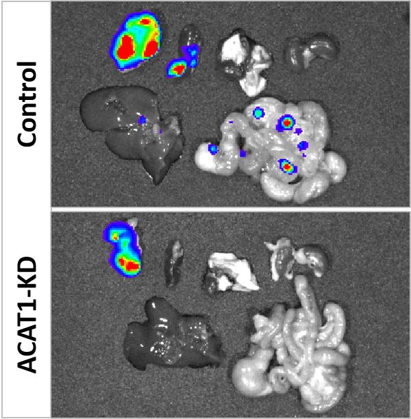 Researchers have shown how controlling cholesterol metabolism in pancreatic cancer cells reduces metastasis to other organs, pointing to a potential new treatment. Findings showed a higher number of metastatic lesions in organs of untreated and treated mice, shown at top and bottom, respectively. Source: Purdue University image/Junjie Li