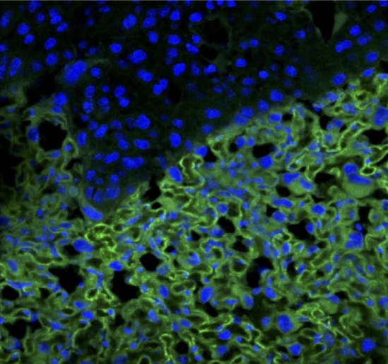 Novel peptides attached to the surface of liposomes create nanocarriers capable of targeting drugs to the placenta. Here, they are shown binding to the placental labyrinth of a mouse. Credit: Lynda Harris, University Of Manchester