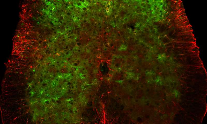 Salk Institute scientists show the surprising involvement of cells called astrocytes in spinal sensory processing. Here, astrocytes (genetically labeled in green) in a spinal cord (co-stained with glial fibrillary acidic protein, red, to visualize its outline) react to the activity of sensation with their own chemical signals. Credit: Salk Institute