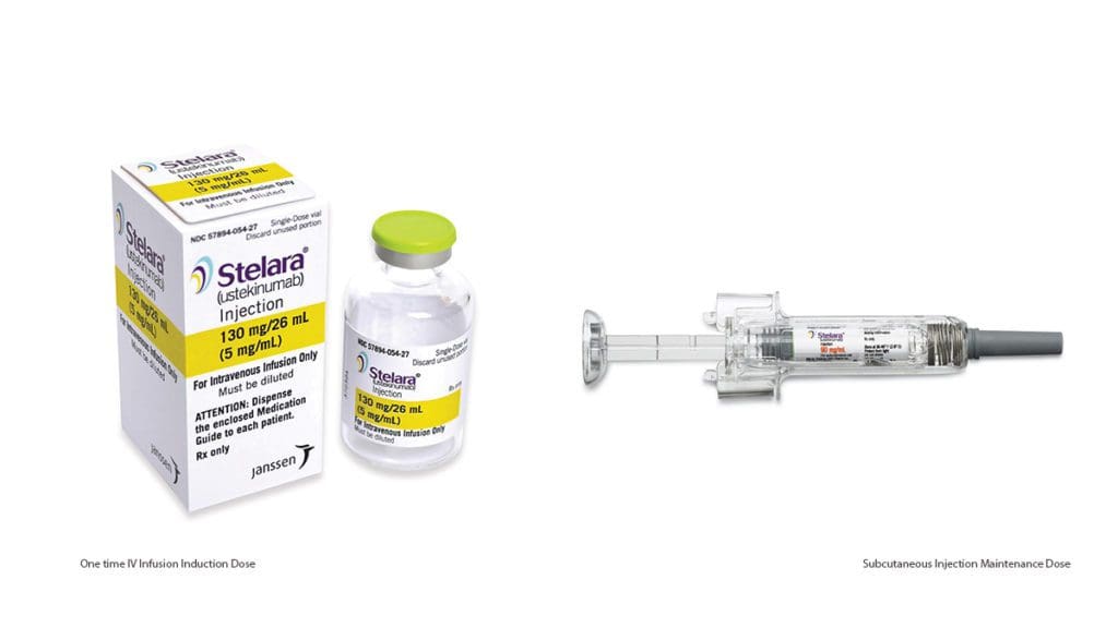 Stelara Shows Promise For Long term Management Of Ulcerative Colitis stelara-shows-promise-for-long-term-management-of-ulcerative-colitis