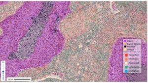 Digital pathology