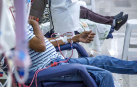 hemodialysis in people on the equipment