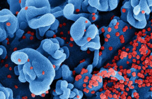 Novel coronovirus