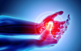 3D illustration of Palm painful - skeleton x-ray, medical concept.