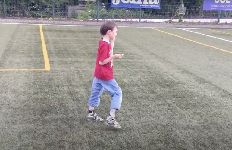 An 8-year-old patient with gangliosidosis demonstrates improved mobility, walking unassisted on a soccer field after treatment with N-acetyl-L-leucine. (Still from video footage; parental consent obtained for use).
