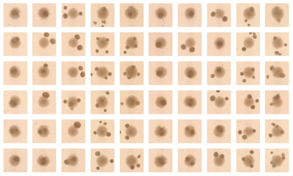 A plate of organoids after being treated with various doses of a drug for testing using Parallel Bio's Clinical Trial in a Dish.