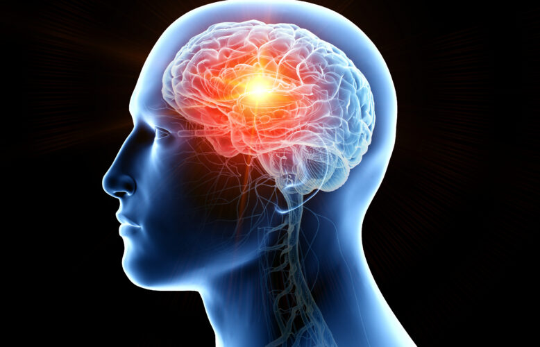 3d rendered medically accurate illustration of human brain cancer