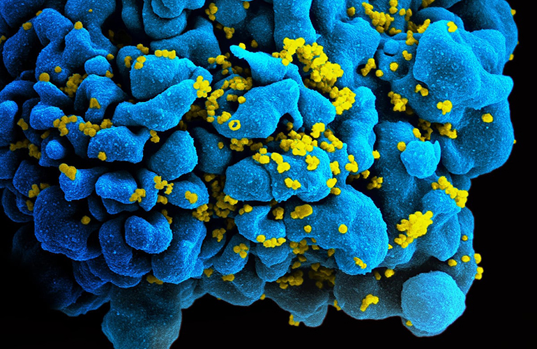 FDA greenlights ViiV’s Tivicay PD for HIV-positive newborns in first month of life