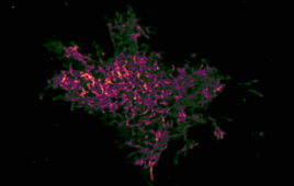 New cell imaging method reveals hidden enzyme activity